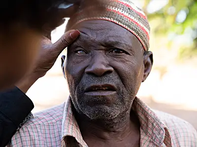 A man has his eyes examined for trachoma in Mozambique.