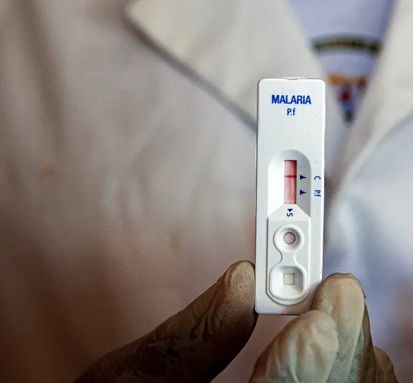 Technician holding a malaria test