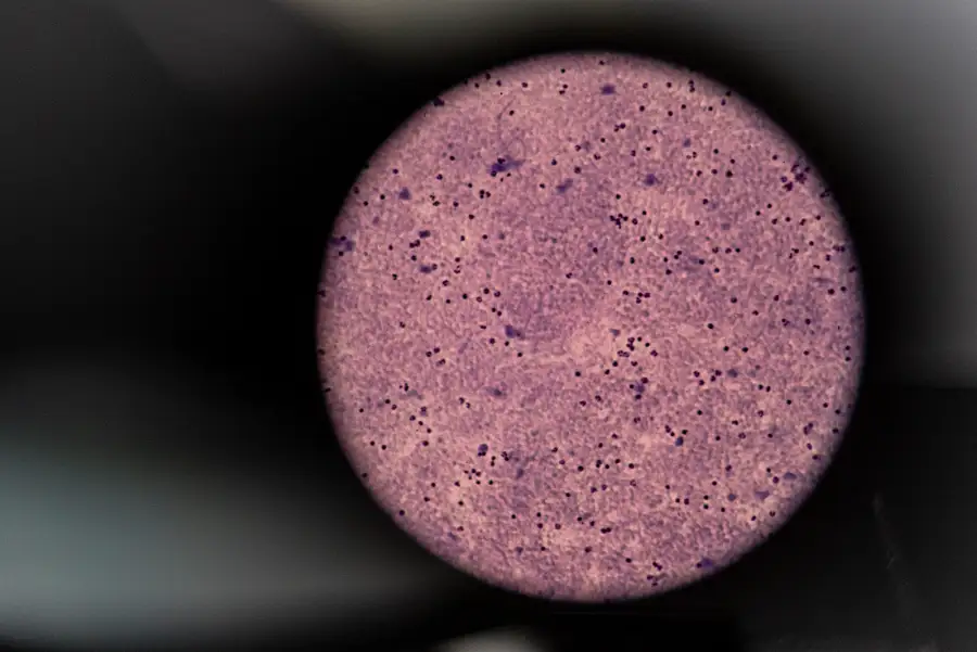 Blood sample through a microscope lens