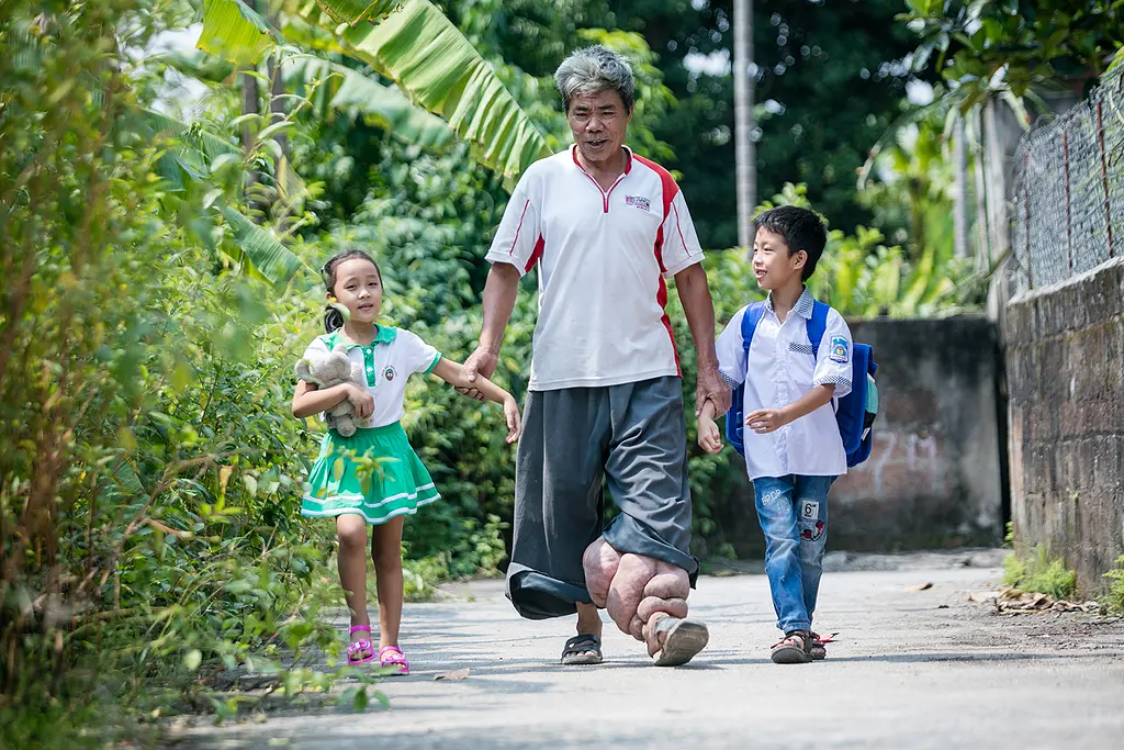 A Vietnamese man who suffers from lymphedema caused by lymphatic filariasis walks with his grandchildren.