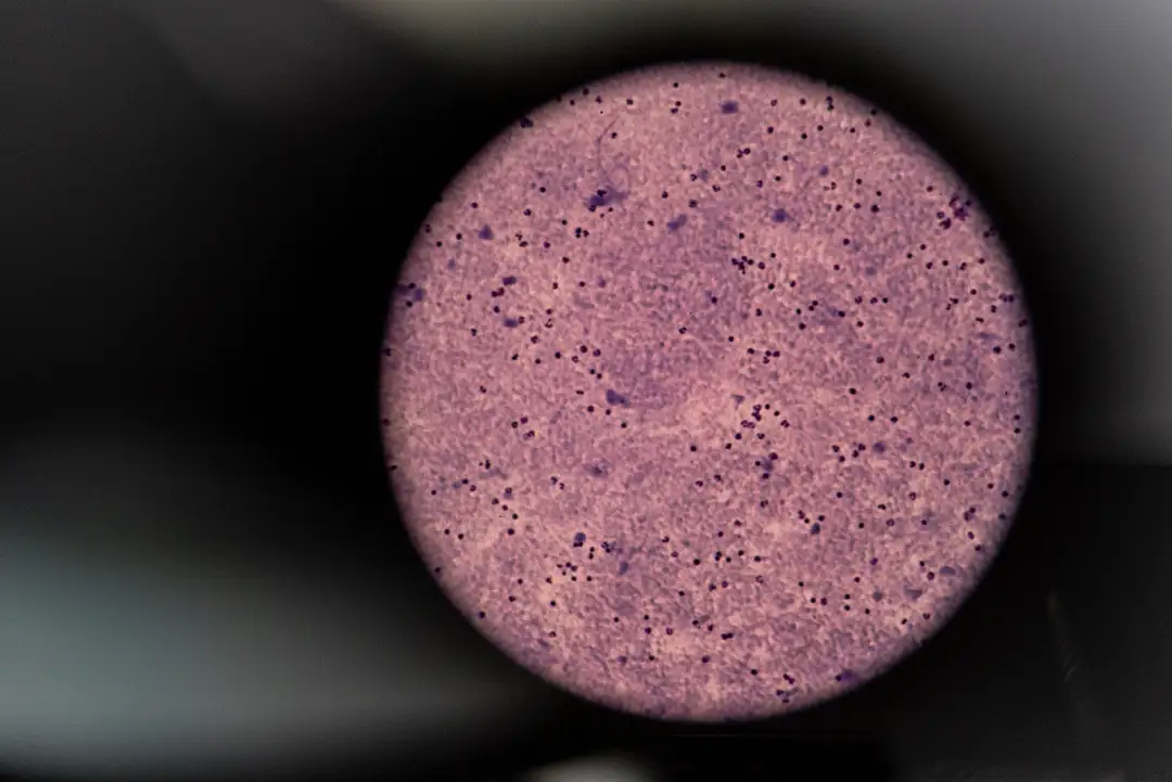 Blood sample through a microscope lens