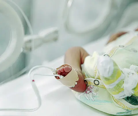 Foot of preterm infant