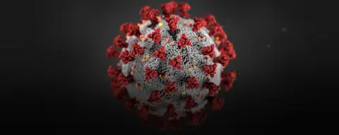 A microscopic view of the novel coronavirus that causes COVID-19.