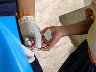 LF patient receives treatment