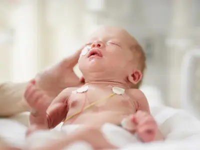 Preterm infant