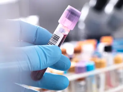 Blood sample
