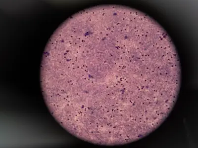 Blood sample through a microscope lens