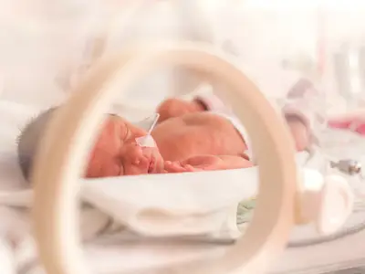 A closeup of a baby girl in a neonatal intensive care unit.