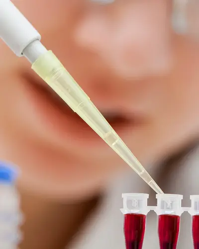 Close-up of a lab technician pipetting samples
