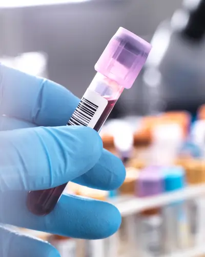 Blood sample