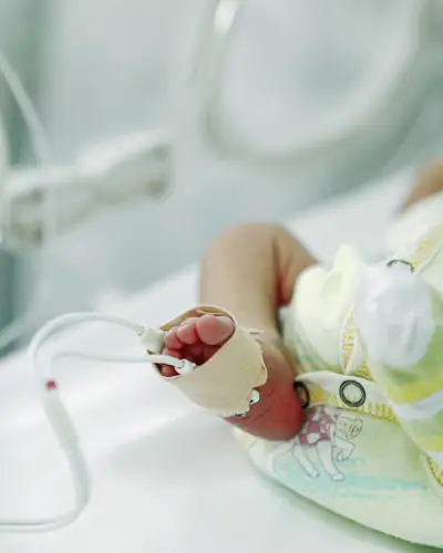 Foot of preterm infant