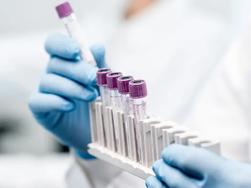 A scientist in a white lab coat works with test tubes.