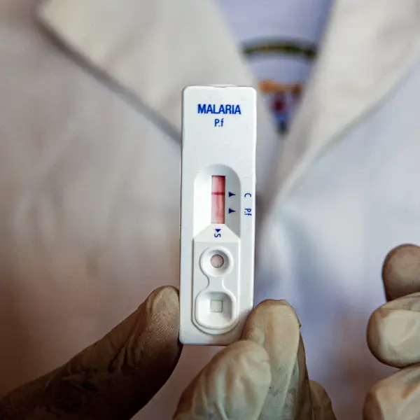 Technician holding a malaria test