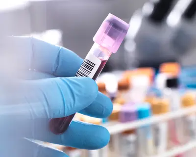 Blood sample