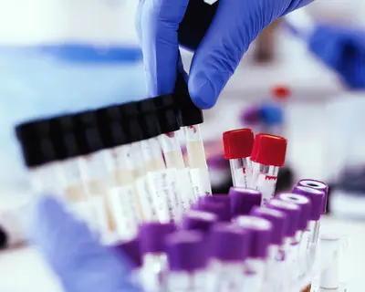 A technician conducts a lab test.