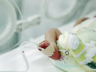 Foot of preterm infant