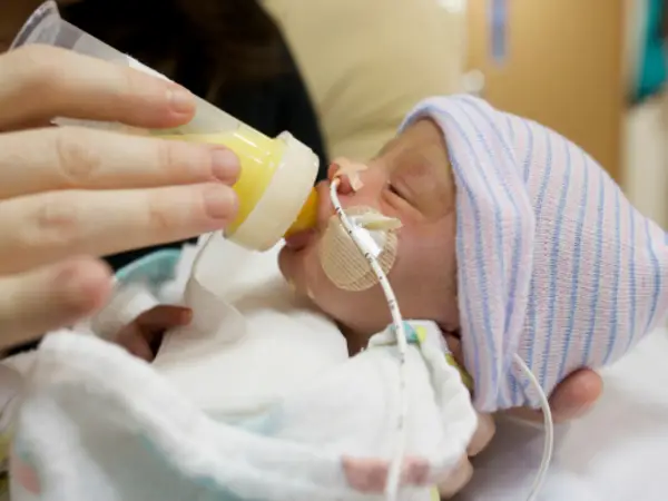 A premature baby drinks from a bottle